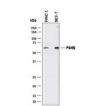 PDI Antibody in Western Blot (WB)