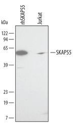 SKAP55 Polyclonal Antibody