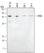 PAK6 Polyclonal Antibody