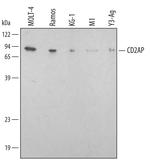 CD2AP Polyclonal Antibody