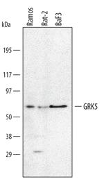 GRK5 Polyclonal Antibody
