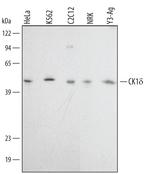 CK1 delta Polyclonal Antibody