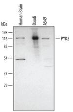 PYK2 Polyclonal Antibody