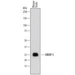 CRISP1 Polyclonal Antibody