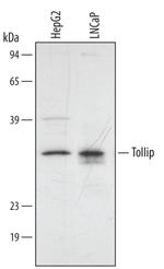 TOLLIP Polyclonal Antibody