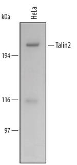 Talin 2 Polyclonal Antibody