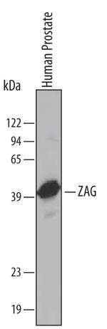 AZGP1 Polyclonal Antibody