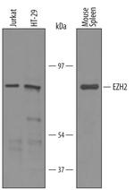 EZH2 Polyclonal Antibody