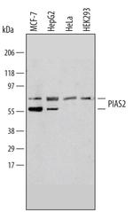 PIAS2 Polyclonal Antibody