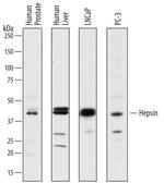 Hepsin Polyclonal Antibody