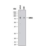 GRK3 Polyclonal Antibody