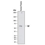 Human IgA Polyclonal Antibody