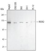 ROCK2 Polyclonal Antibody