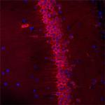 SEZ6L Polyclonal Antibody