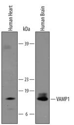 VAMP1 Polyclonal Antibody