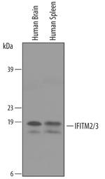 IFITM2/IFITM3 Polyclonal Antibody
