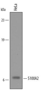 S100A2 Polyclonal Antibody