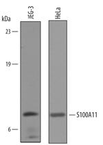 S100A11 Polyclonal Antibody