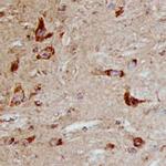 PLTP Polyclonal Antibody