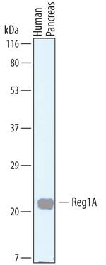 REG1A/REG1B Polyclonal Antibody