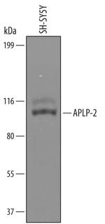 APLP2 Polyclonal Antibody