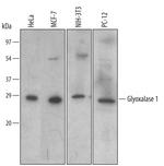 GLO1 Polyclonal Antibody
