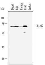 BLNK Polyclonal Antibody
