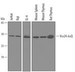TCR V alpha 24 J alpha 18 Polyclonal Antibody