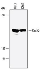 RAD50 Antibody in Western Blot (WB)
