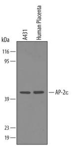 TFAP2E Antibody in Western Blot (WB)