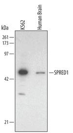 SPRED1 Polyclonal Antibody