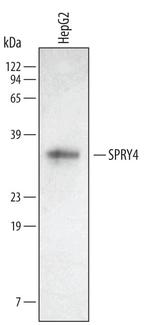 SPRY4 Polyclonal Antibody