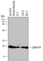 Acid Phosphatase 1 Polyclonal Antibody