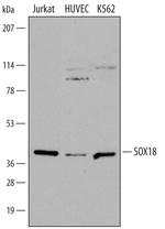 SOX18 Polyclonal Antibody