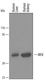 IRF8 Polyclonal Antibody