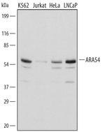 RNF14 Antibody in Western Blot (WB)