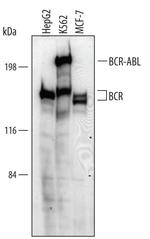 Bcr Polyclonal Antibody