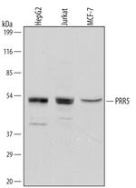 PRR5 Polyclonal Antibody