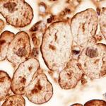 ATGL Polyclonal Antibody