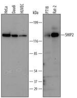 SHIP2 Polyclonal Antibody