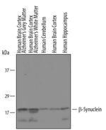 beta Synuclein Polyclonal Antibody