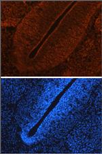LRRTM2 Polyclonal Antibody