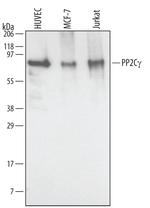 PPM1G Polyclonal Antibody