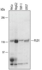 PLD1 Polyclonal Antibody