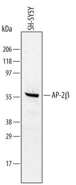 AP2 beta Polyclonal Antibody