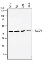 RASSF2 Polyclonal Antibody