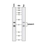 STX5 Polyclonal Antibody