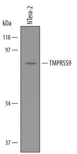TMPRSS9 Polyclonal Antibody