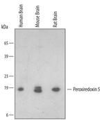 PRDX5 Polyclonal Antibody