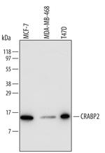 CRABP2 Polyclonal Antibody